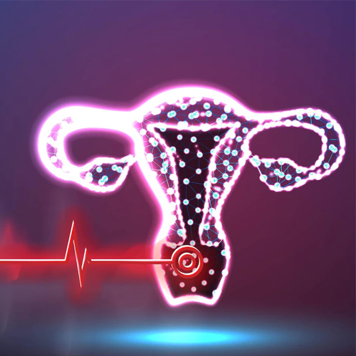 什么是子宫内膜异位症？如何改善子宫环境？